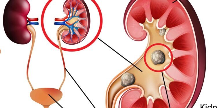 शरीर में दिखे अगर यह सात लक्षण तो हो जाएं सावधान ; दोनों किडनी खराब होने की रहती है संभावना…