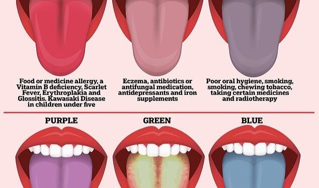 जीभ का रंग बताता है सेहत का हाल, जाने कौन सा रंग क्या देता है संकेत…