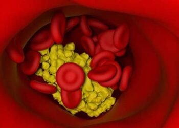 कोलेस्ट्रॉल से चल सकती हैं इलेक्ट्रॉनिक्स, भारतीय वैज्ञानिकों की रिसर्च में दावा…