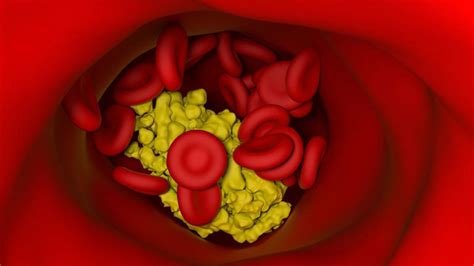 कोलेस्ट्रॉल से चल सकती हैं इलेक्ट्रॉनिक्स, भारतीय वैज्ञानिकों की रिसर्च में दावा…