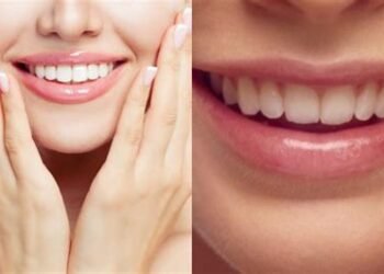 ठंड में होंठों की नमी और गुलाबी चमक बनाए रखें इन आसान घरेलू उपायों से…