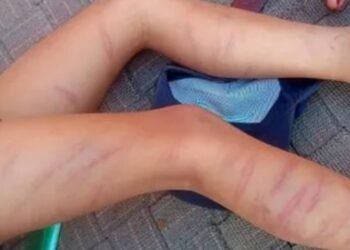 होमवर्क न करने पर मासूम को मारे 105 डंडे, स्कूल टीचर ने दी ‘तालिबानी’ सजा…