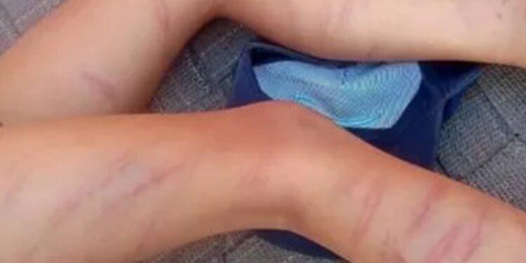 होमवर्क न करने पर मासूम को मारे 105 डंडे, स्कूल टीचर ने दी ‘तालिबानी’ सजा…