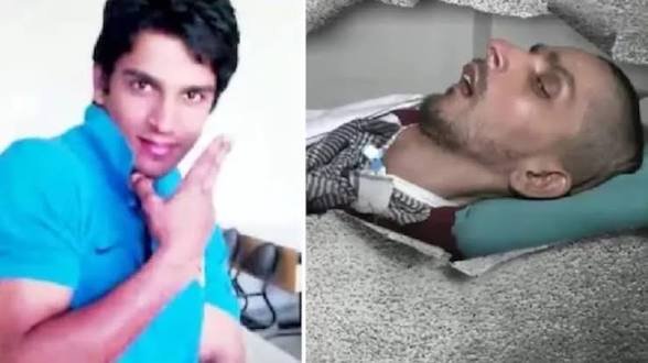 मरकर भी अमर होंगे हरीश इच्छामृत्यु से पहले अंगदान का बड़ा फैसला, कई बुझते चिरागों को मिलेगी नई जिंदगी…